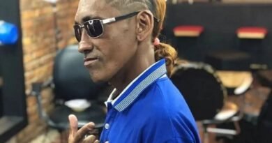 «Elvis Cobra» se encuentra «súper estable»: le harán una tomografía este #4Ago
